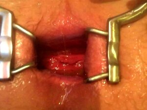 Butthole Porn Bracket - Anal Spreader porn videos at Xecce.com