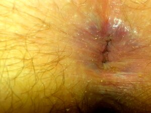 Tumblr Ass Play porn videos at Xecce.com